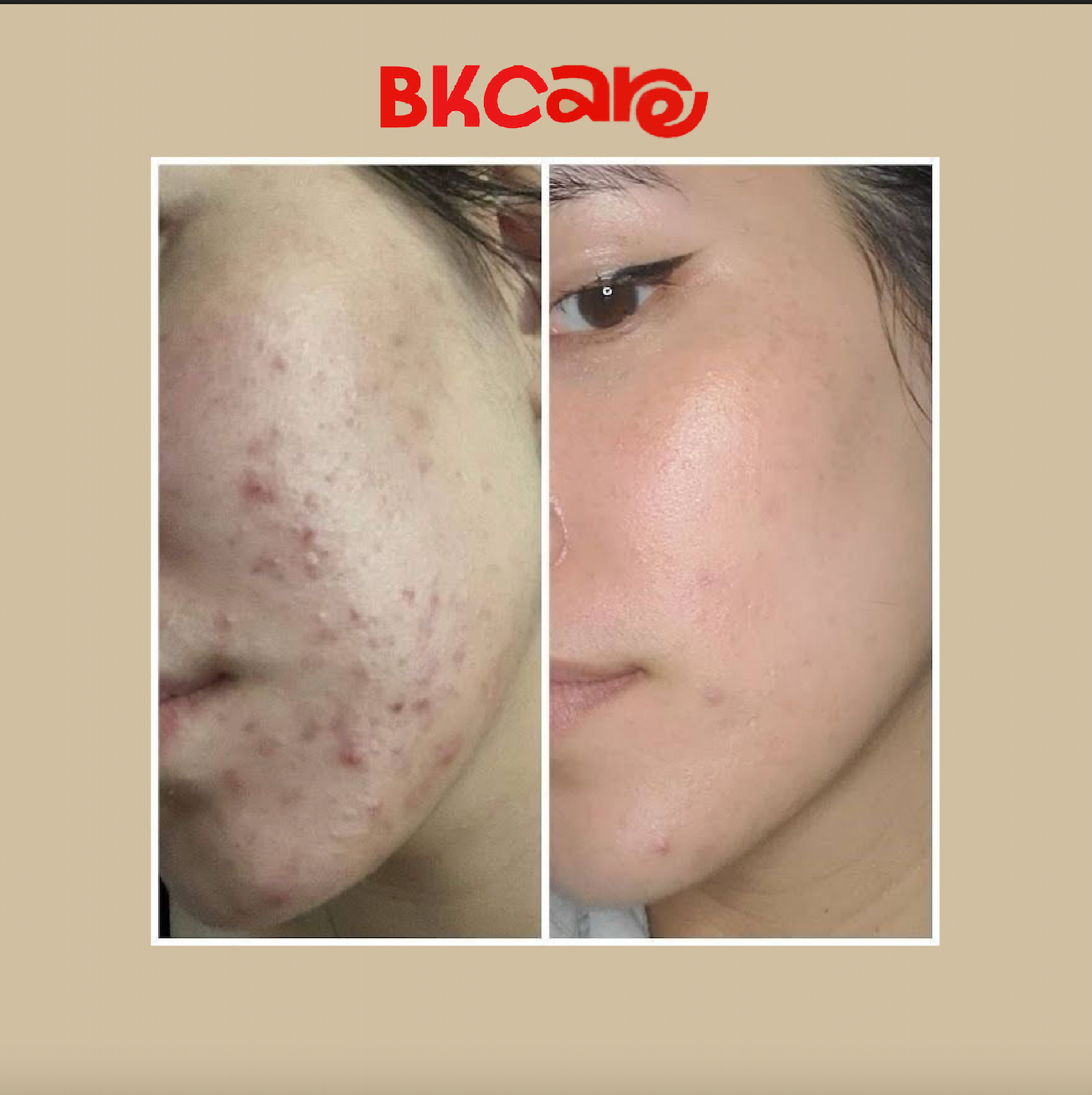 Rice Mud Mask For Glass Skin