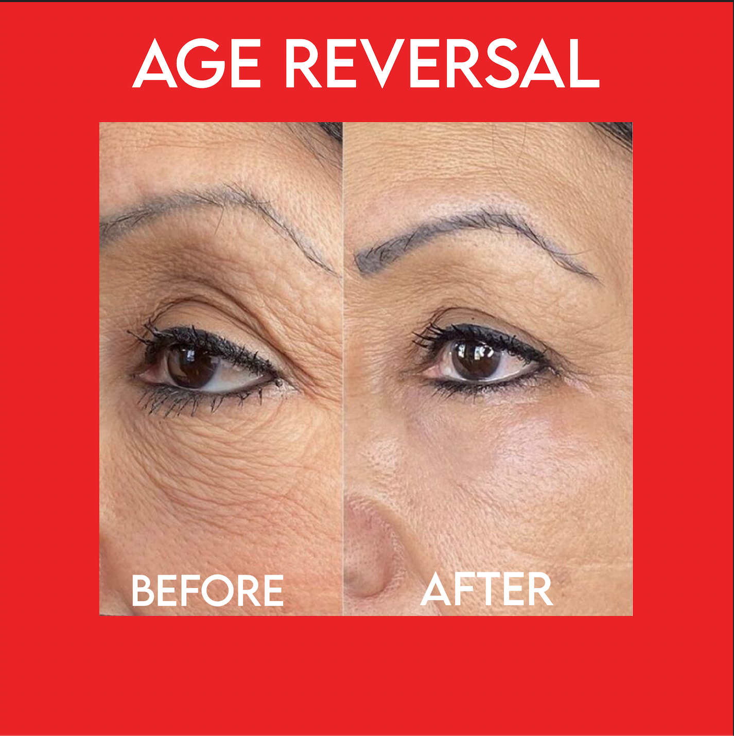 Botox Mud Mask