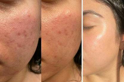 Glass skin tea