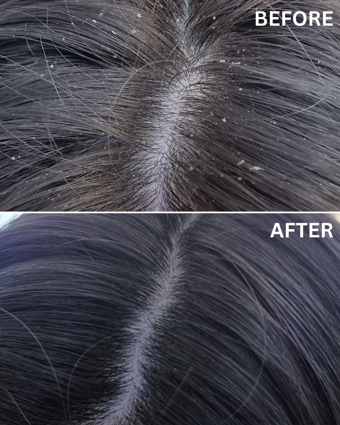 Hydrating Anti Dandruff Shampoo