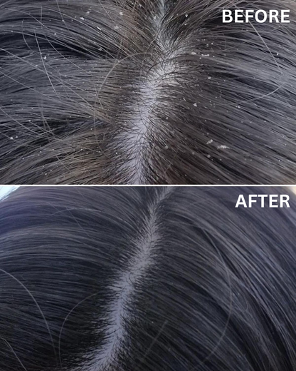 Hydrating Anti Dandruff Shampoo